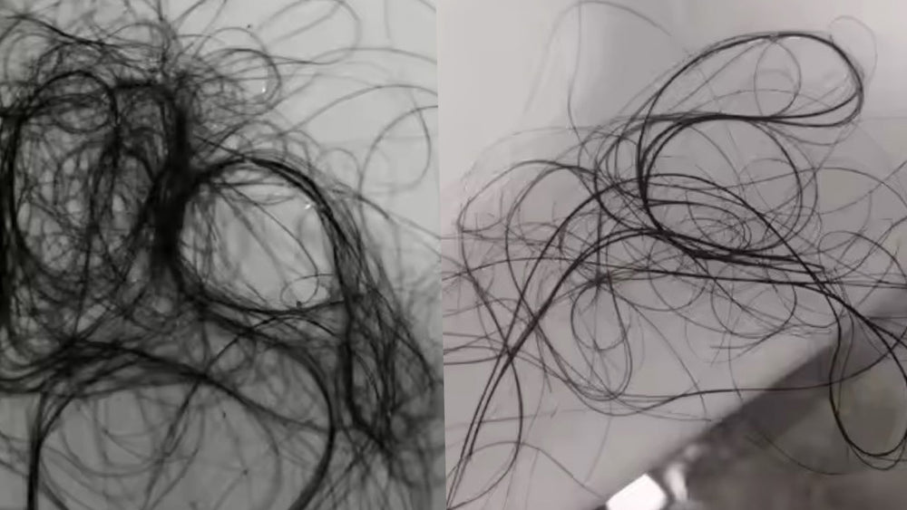 <h2>Healthy Scalp. Stronger, Fuller Hair.</h2>