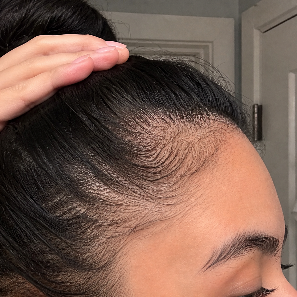 <h2>Healthy Scalp. Stronger, Fuller Hair.</h2>