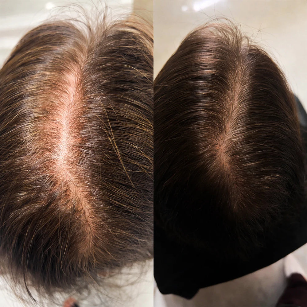 <h2>Healthy Scalp. Stronger, Fuller Hair.</h2>
