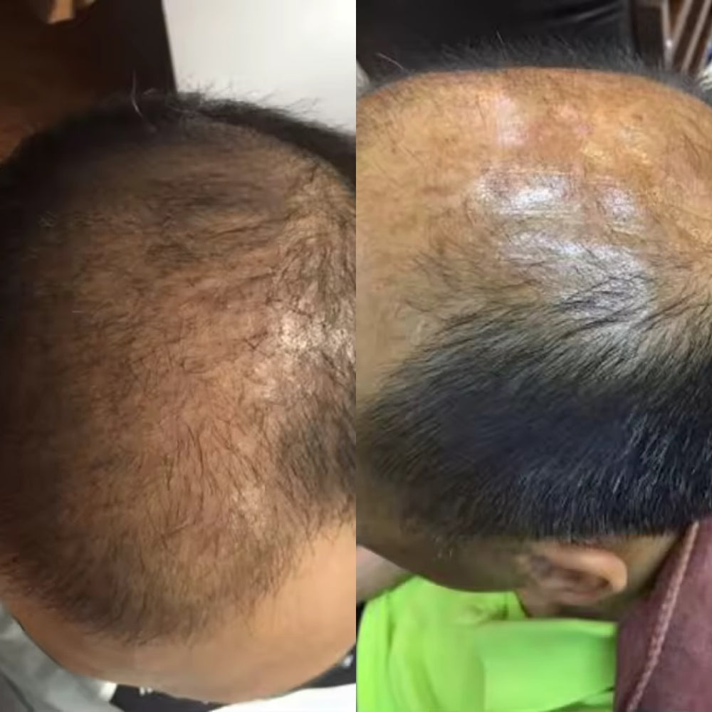 <h2>Healthy Scalp. Stronger, Fuller Hair.</h2>